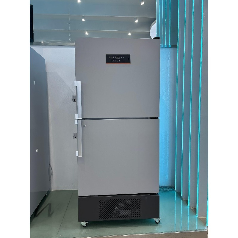Vertical deep freezer - 25 deg - Medical Lab Degree ulasan dan harga